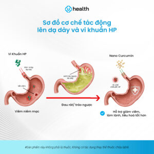 Sơ đồ cơ chế tác động lên dạ dày & HP