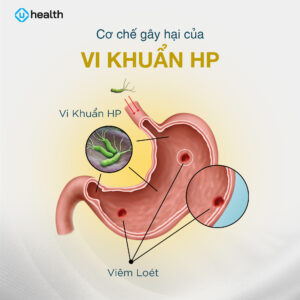 Cơ chế gây hại của vi khuẩn HP