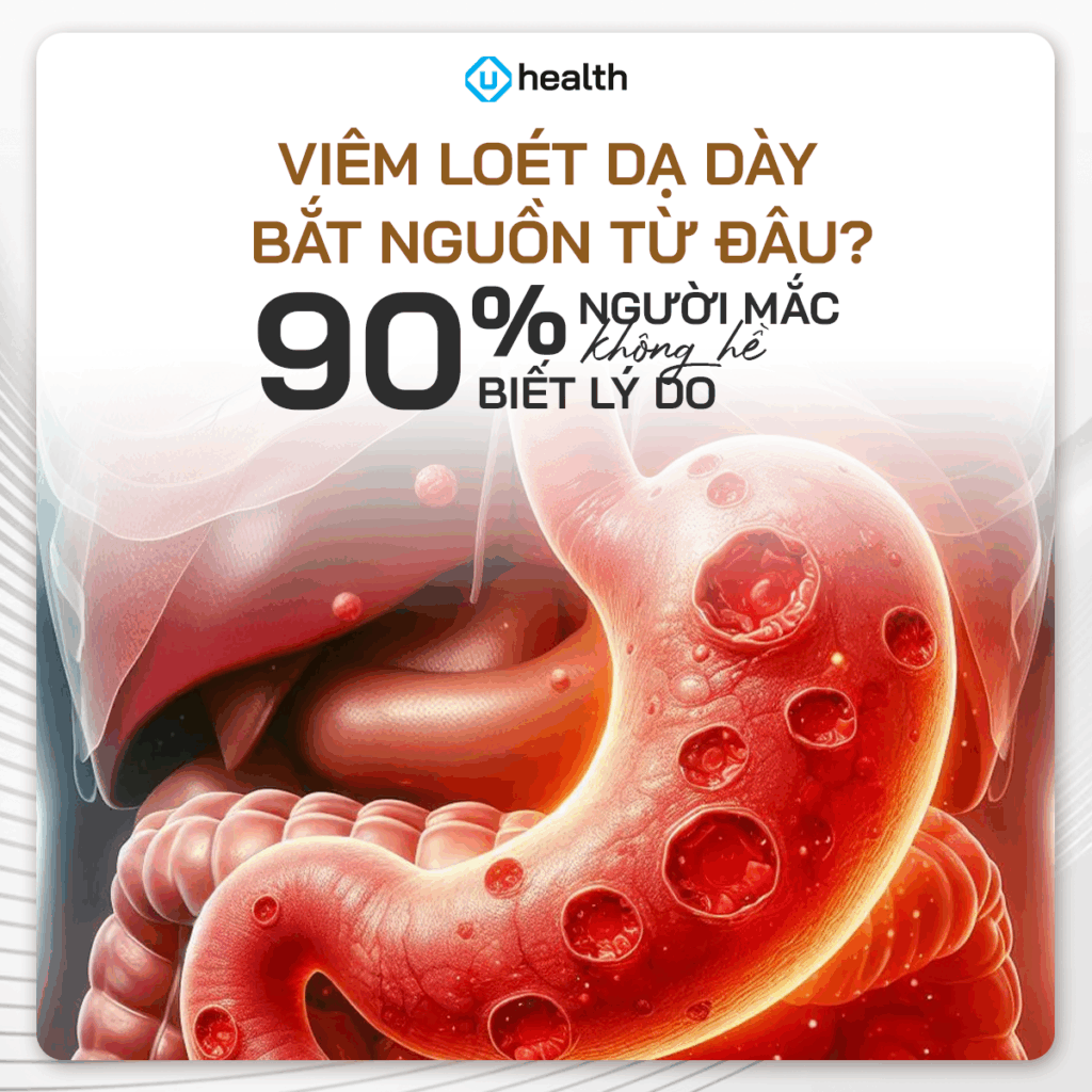 Viêm Loét Dạ Dày Bắt Nguồn Từ Đâu? 90% Người Mắc Không Hề Biết Lý Do Viêm Loét Dạ Dày Bắt Nguồn Từ Đâu? 90% Người Mắc Không Hề Biết Lý Do
