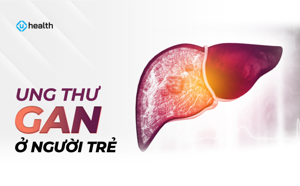 Ung thư gan ở người trẻ: Cái giá đắt của ăn uống không kiểm soát, nhậu nhẹt và thức đêm liên tục Ung thư gan ở người trẻ: Cái giá đắt của ăn uống không kiểm soát, nhậu nhẹt và thức đêm liên tục