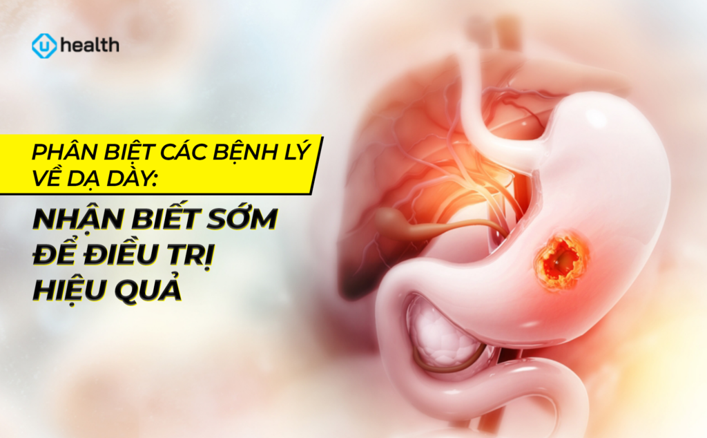 Phân biệt các bệnh lý về dạ dày: Nhận biết sớm để điều trị hiệu quả Phân biệt các bệnh lý về dạ dày: Nhận biết sớm để điều trị hiệu quả