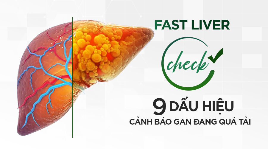 9 Cảnh BÁO Dấu Hiệu Tổn Thương Gan & Bài Test FAST LIVER 9 Cảnh BÁO Dấu Hiệu Tổn Thương Gan & Bài Test FAST LIVER