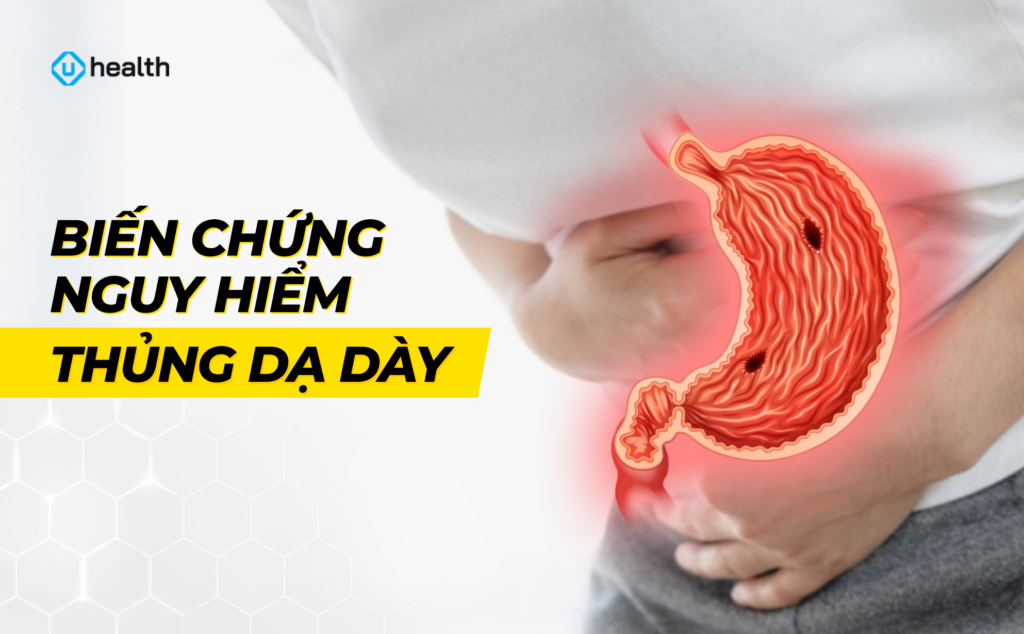 Cảnh giác với biến chứng nguy hiểm thủng dạ dày Cảnh giác với biến chứng nguy hiểm thủng dạ dày